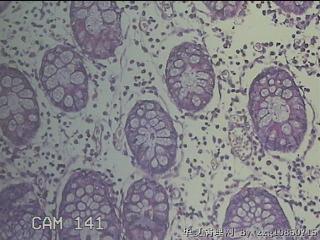 远端横结肠粘膜图13