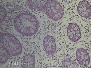 远端横结肠粘膜图19