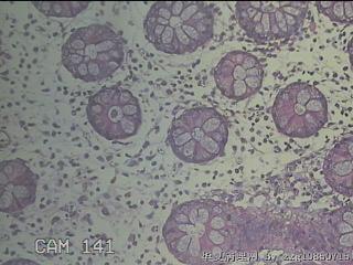 远端横结肠粘膜图27