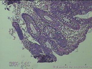 远端横结肠粘膜图35
