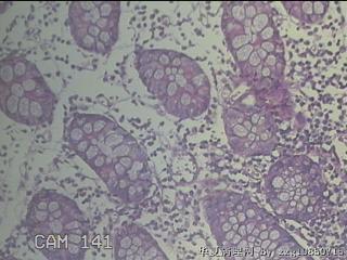 远端横结肠粘膜图18