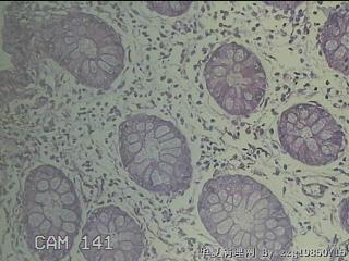 远端横结肠粘膜图31