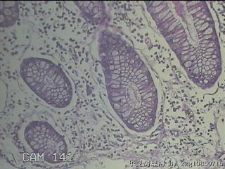 远端横结肠粘膜图17