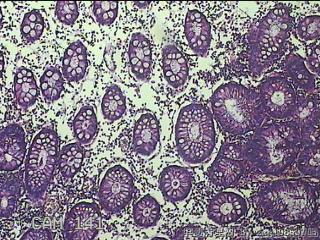 远端横结肠粘膜图51