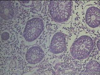 远端横结肠粘膜图14