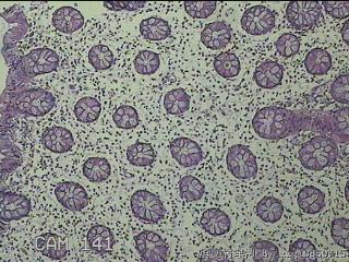 远端横结肠粘膜图42