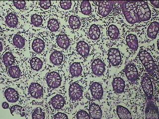 远端横结肠粘膜图46