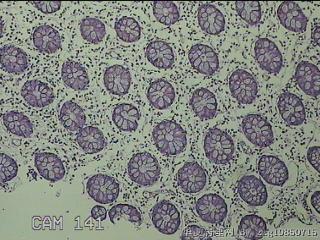 远端横结肠粘膜图40