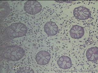远端横结肠粘膜图28