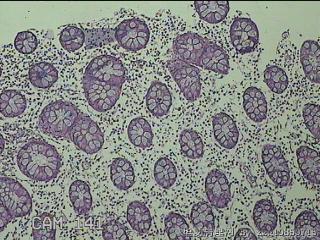 远端横结肠粘膜图38