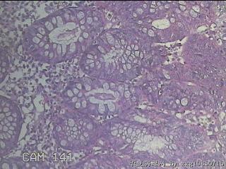 远端横结肠粘膜图3