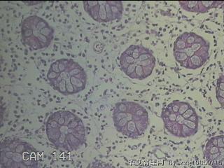 远端横结肠粘膜图26