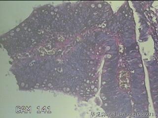 距肛门28cm处粘膜图43