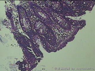 远端横结肠粘膜图55