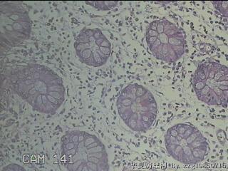 远端横结肠粘膜图30