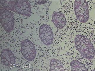 远端横结肠粘膜图12