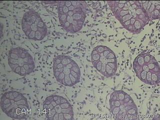 远端横结肠粘膜图22