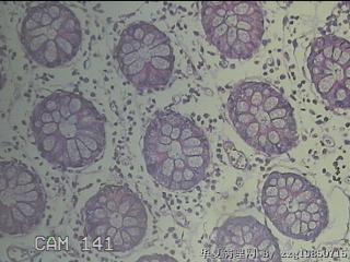 远端横结肠粘膜图23