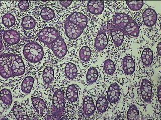 远端横结肠粘膜图48