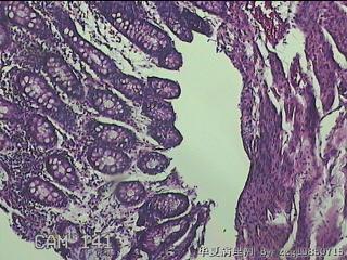 乙状结肠粘膜图7