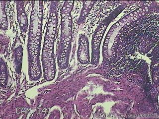乙状结肠粘膜图8