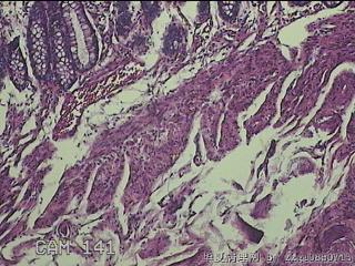 乙状结肠粘膜图9