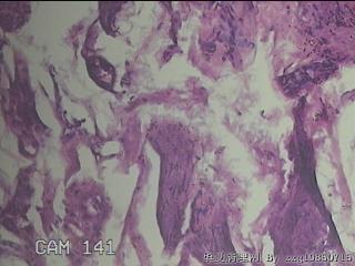 乙状结肠粘膜图21