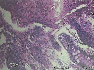 乙状结肠粘膜图19