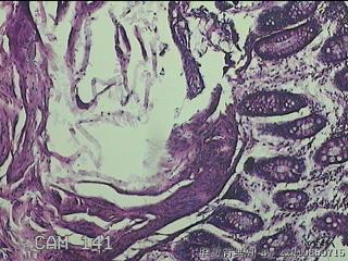 乙状结肠粘膜图1