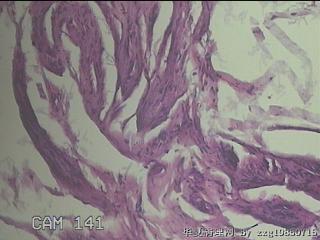 乙状结肠粘膜图18