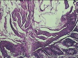 乙状结肠粘膜图2