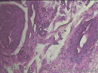乙状结肠粘膜图16