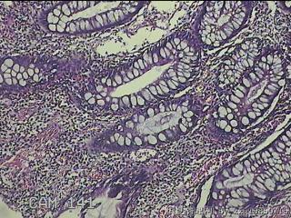 升结肠粘膜图5