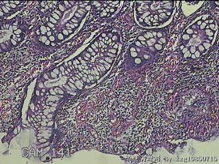 升结肠粘膜图4