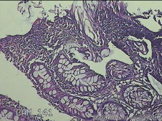 升结肠粘膜图7