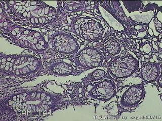 升结肠粘膜图6