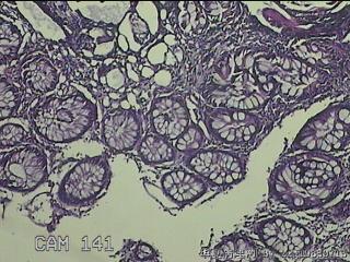 升结肠粘膜图2
