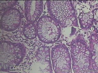 距肛门25cm粘膜图38