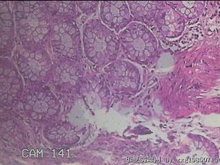 乙状结肠粘膜图35
