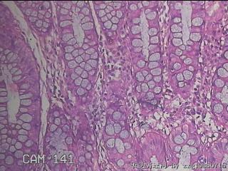 乙状结肠粘膜图30