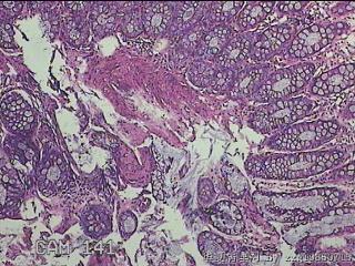 乙状结肠粘膜图12