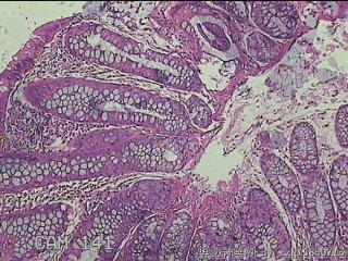 乙状结肠粘膜图2