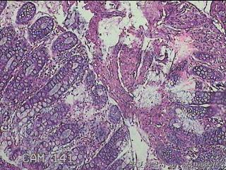 乙状结肠粘膜图10