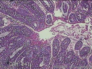 乙状结肠粘膜图16