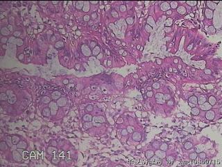 乙状结肠粘膜图26