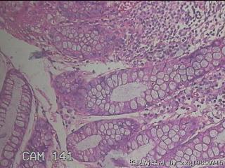 乙状结肠粘膜图19