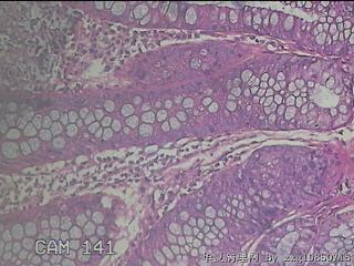乙状结肠粘膜图39