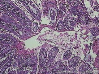乙状结肠粘膜图13