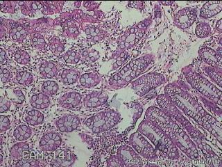 乙状结肠粘膜图6