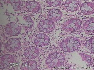 乙状结肠粘膜图27